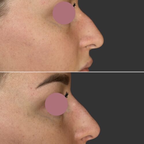 Screenshot Screenshot