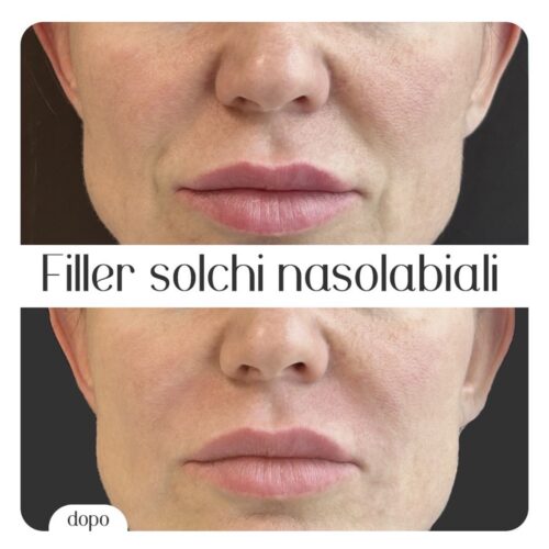 Screenshot Screenshot